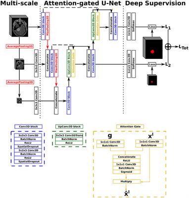 Meningioma Segmentation in T1-Weighted MRI Leveraging Global Context and Attention Mechanisms